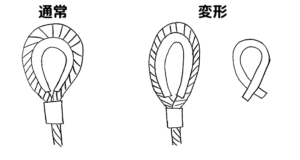 シンブルの変形例